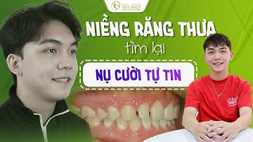 Tìm lại nụ cười tự tin sau niềng răng thưa - KH Mai Nguyễn Gia Huy HN14638