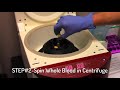 Platelet rich plasma prp preparation to some cool music