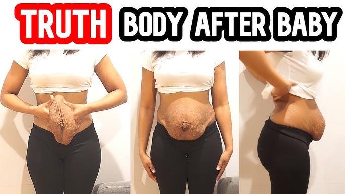 MY BODY AFTER PREGNANCY / MY POSTPARTUM BODY / SAGGY SKIN / BODY  TRANSFORMATION JOURNEY / SAHM 