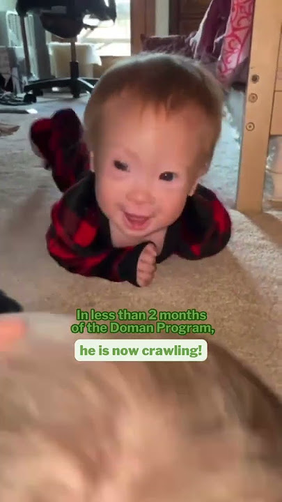 Crawling Improvement with Doman Method for child with Trisomy 21