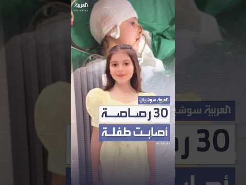 30 رصاصة إسرائيلية على سيارة عائلة فلسطينية قرب نابلس وطفلة بوضع حرج