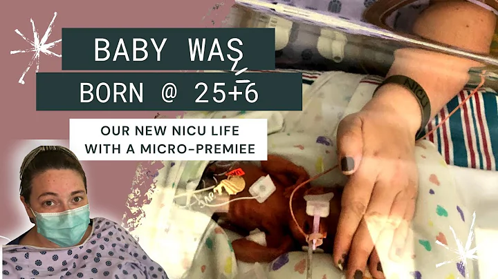 Our baby was born at 25 weeks | preeclampsia and low amniotic fluid  | Our micro premiee birth story