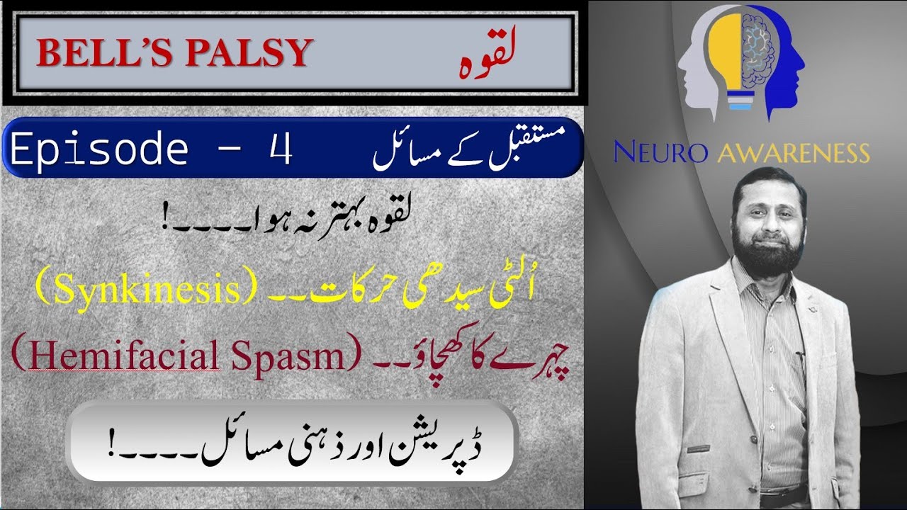 Bell's Palsy: Synkinesis, Hemifacial spasm.     لقوہ سے متعلق دائمی مسائل   / Dr Ali Hassan
