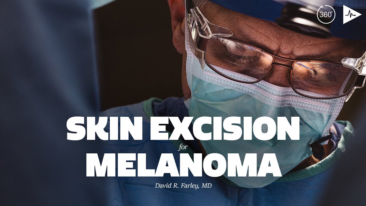 Skin Excision for Melanoma by David R. Farley, MD | Case Trailer mayo clinic careers