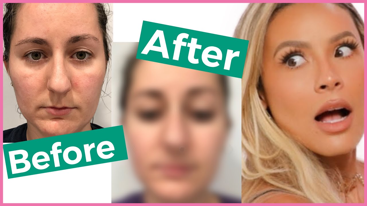 Dezi Skin Vitamin C Serum Transformed My Skin! (6 Week Update) YouTube