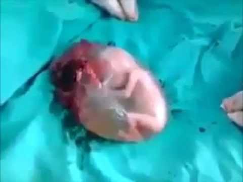 Video: Bilakah Fetus Mendengar: Garis Masa Pembangunan Womb