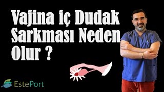 Vajina iç Dudak Sarkması Neden Olur