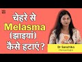 (Melasma) झाइयां हटाने का सही तरीका - Dr. Sanchika Gupta