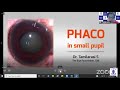 Dr tamilarasi  phaco in small pupil  the eye foundation academic educations