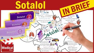 Sotalol 80 mg (Betapace): What Is Sotalol Used For? Uses, Dosage and Side Effects of Sotalol