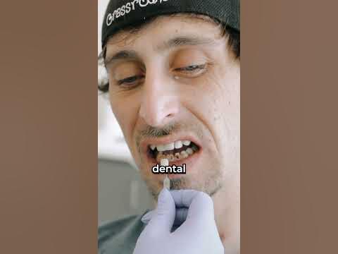 He Did One Thing To His Teeth That Left Everyone Speechless 🤯🦷 #shorts(05)