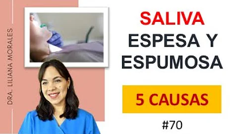 ¿Por qué mi saliva es tan espesa y blanca?