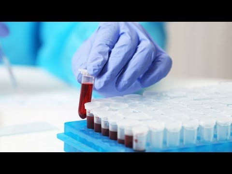 Scientists Make Progress on Blood Test to Detect the Most Deadly Cancers