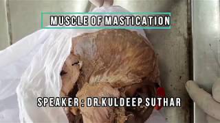Muscle of Mastication - Gross Anatomy