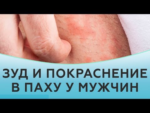 Зуд и покраснение в паху у мужчин