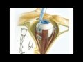 Color atlas of ophthalmology