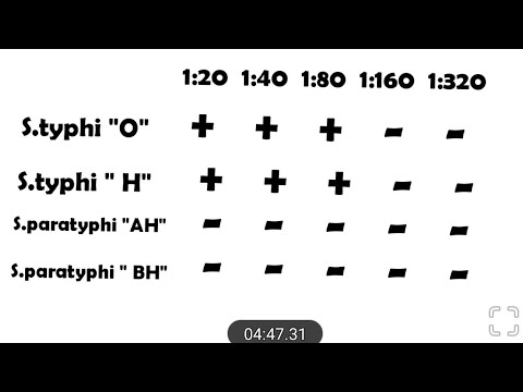 Видео: Видал тестийг хэрхэн тайлбарлах вэ?