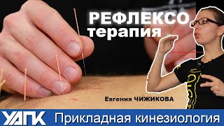 картинка: Коррекция эмоций иглами (Е.Чижикова)