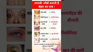 आपकी आँखें बताती है सेहत का राज #gk #gktricks #gkquestions #education #gkgs #gkindia #gkquiz