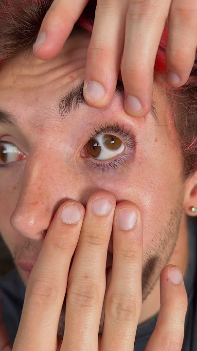 Algo MUY RARO me pasó en el ojo😱👁️🤯