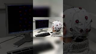 China’s Brain-Computer Interface Explosion: Q1 Funding Crushes 2025 Records!