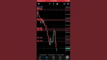 Buy or Sell? Price Action Strategy #forextrading #forexscalping #xauusd #like #tiktok #viral #live