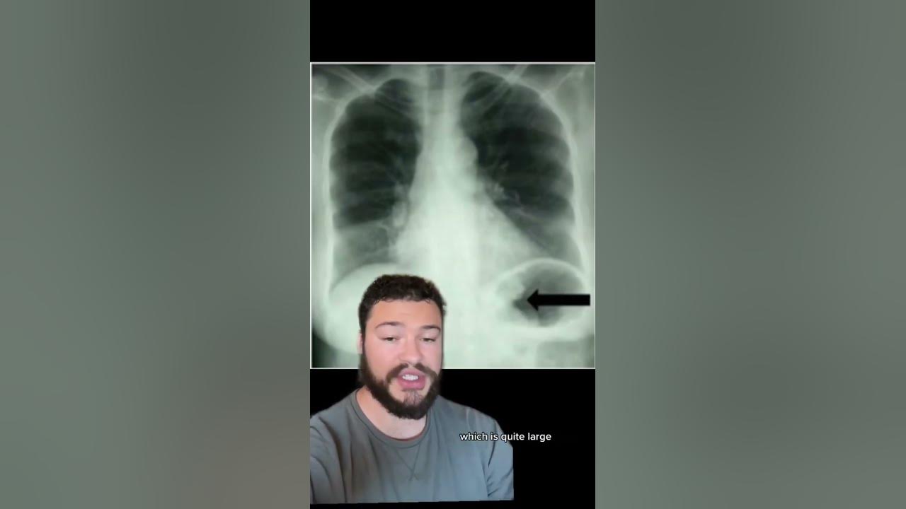 The Worst Medical Mistakes Ever Made Part 12 disturbing YouTube the-worst-medical-mistakes-ever-made-part-12-disturbing-youtube