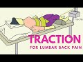 Traction for low back pain.