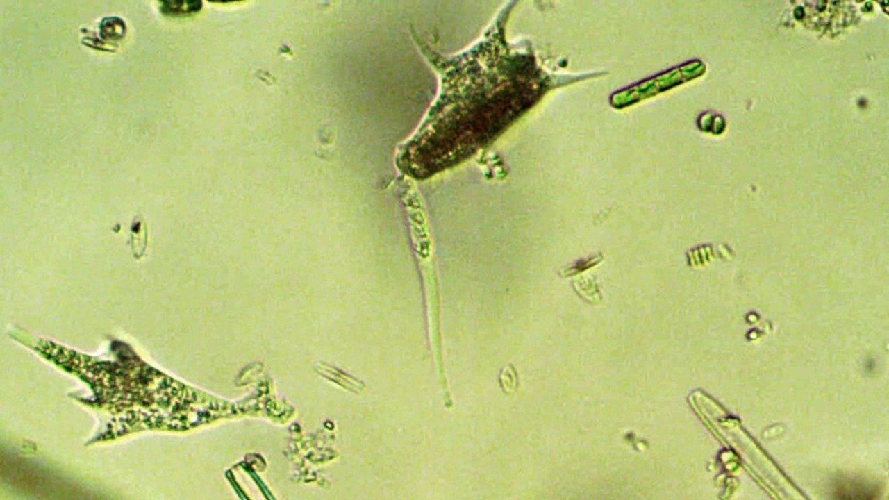 articulating pseudopods basally youtube how do pseudopods form