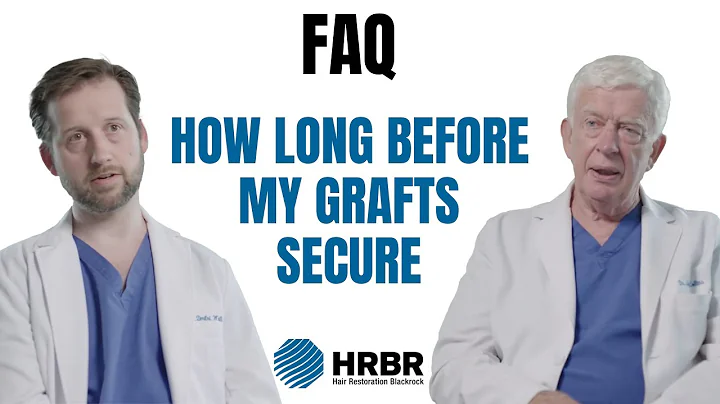 FAQ: How long after my hair transplant are my grafts secure? - Hair Restoration Blackrock - DayDayNews