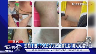 遊墾丁要小心! 上百民眾皮膚紅疹 疑毛毛蟲引起｜TVBS新聞