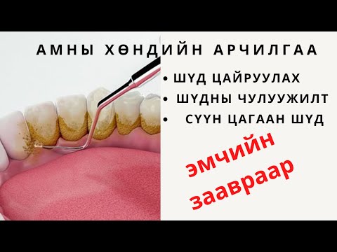 Видео: Шүдний оо хаанаас гардаг вэ?