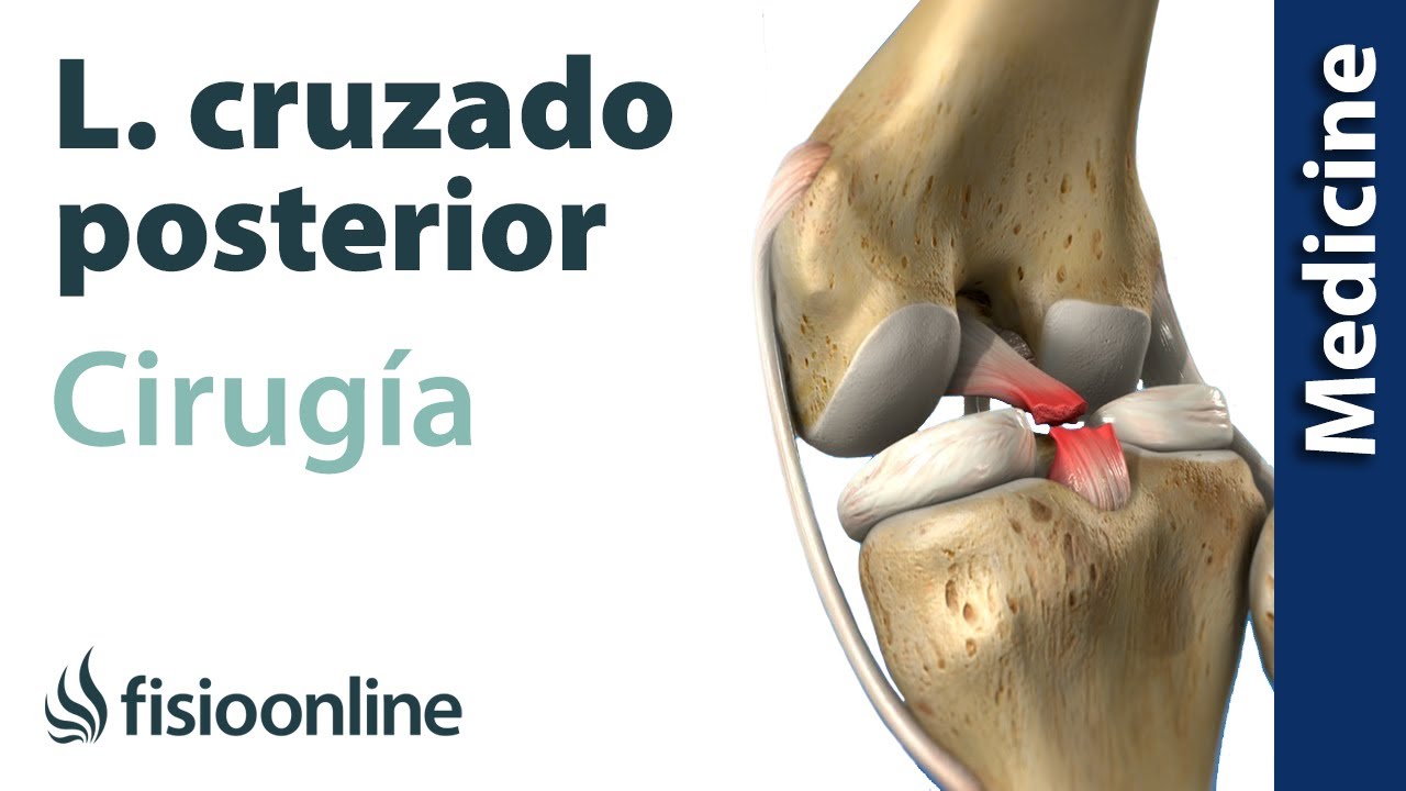 Ligamento cruzado