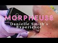 Morpheus8 Spotlight: Danielle Smith's Experience