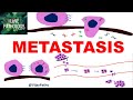 NEOPLASIA 8: INVASION AND METASTASIS; Mechanisms, Pathways of Spread