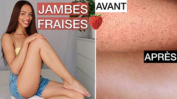 Pourquoi j'ai des jambes de fraises