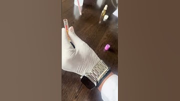 Hemoglobin Estimation by Sahli’s method