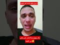 بكاء ونهيار هذا الشاب على ما هى القصة اكسبلور شيررر التغطيه هاشتاج