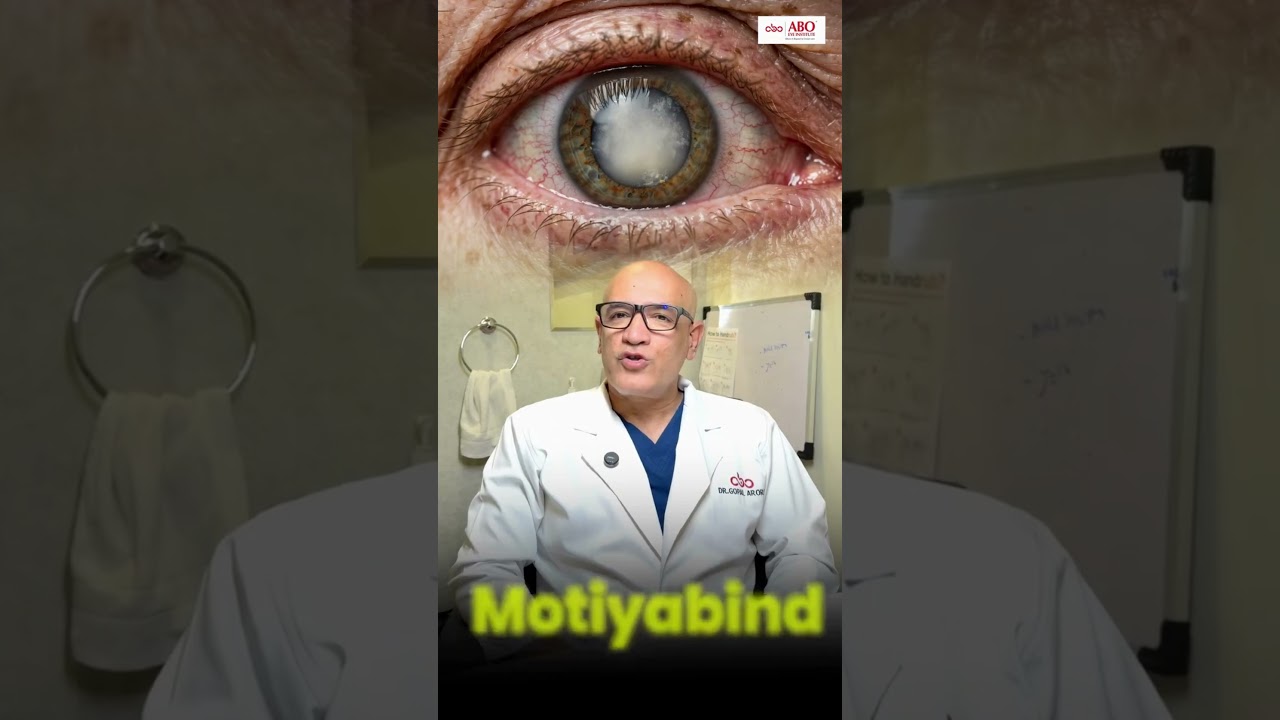 आपकी आंखों में Cataract है 🥹👁️ #shortvideo #viralvideo