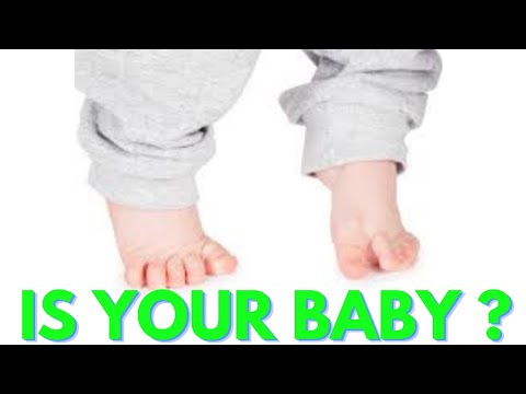 Toe Walking in babies and toddlers/ Essential Exercises /What Every Parent should know [Greek subs]