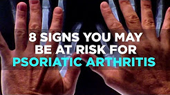 8 Signs You May be at Risk for Psoriatic Arthritis