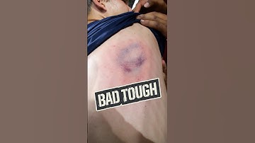 BEANED by 98 mph…TWICE IN ONE AT BAT?! 😱🤯