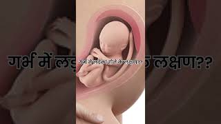 गर्भ में लड़का होने के लक्षण | Without Ultrasound Garbh Me Ladka Hone Ke Lakshan | Dr Neeraj