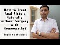 How to treat fistula naturally without surgery with homeopathy  dr rohit jain explains