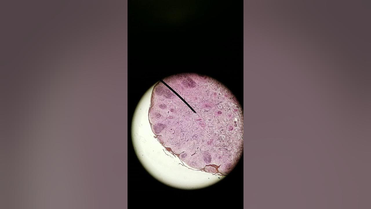 Mesenchyme and Connective tissue proper histology - YouTube