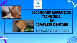 SECONDARY  IMPRESSION TECHNIQUE IN COMPLETE DENTURE |FINAL CAST POURING |PROSTHODONTICS