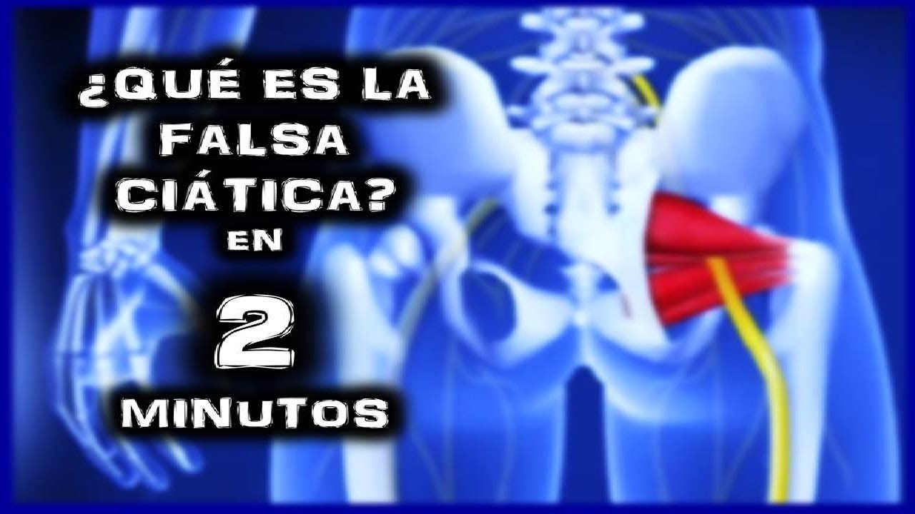 ejercicios ciatica pierna derecha ¿QUÉ ES UNA FALSA CIÁTICA O SINDROME PIRAMIDAL? EN 2 MINUTOS - YouRamTube