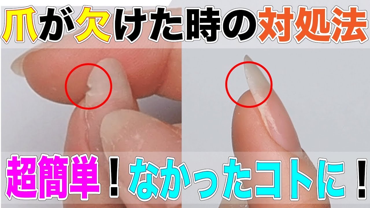 爪が欠けた時の対処法 自爪が割れやすい人必見 簡単爪修復法 Youtube