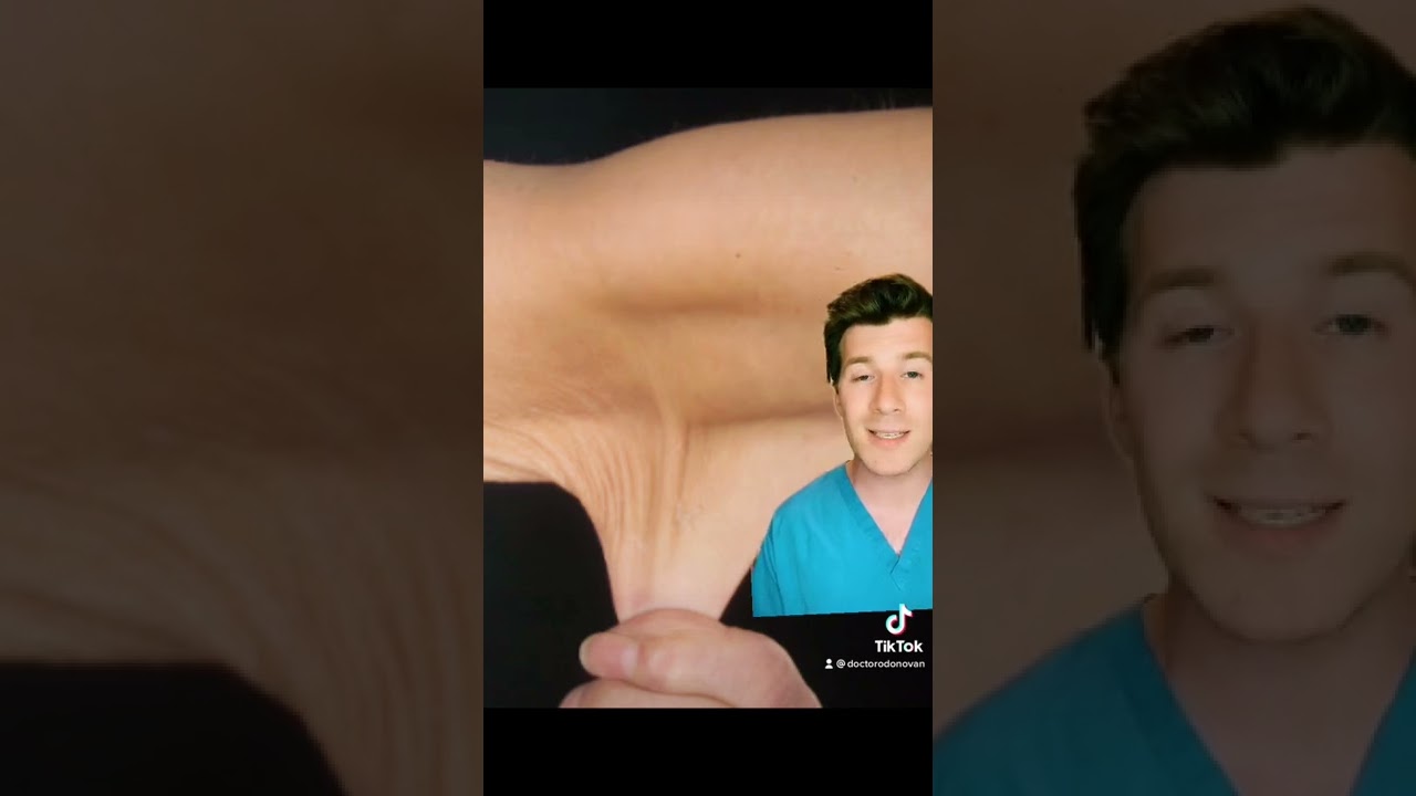 A lady with 'stretchy' skin and hypermobile joints.... what's the diagnosis? 