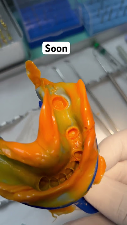 Impression #dentisry #dentalprocedure #dentist